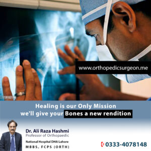 Best Orthopedic Surgeon in Lahore