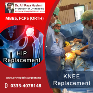 Knee Replacement Surgery in Lahore