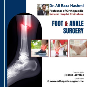 foot and ankle surgey - best orthopedic surgeon in dha lahore