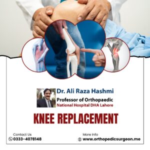 knee replacement - best orthopedic surgeon - lahore pakistan